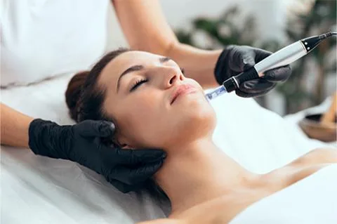 Micro-Needling Behandlung